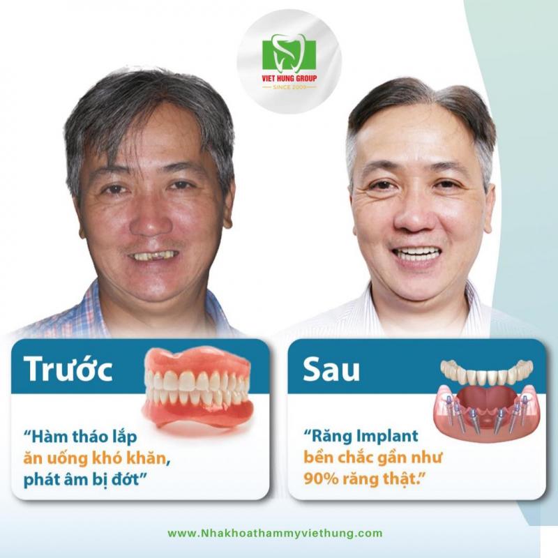 Nha khoa thẩm mỹ Việt Hưng