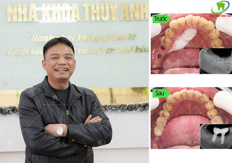 Nha khoa Thùy Anh