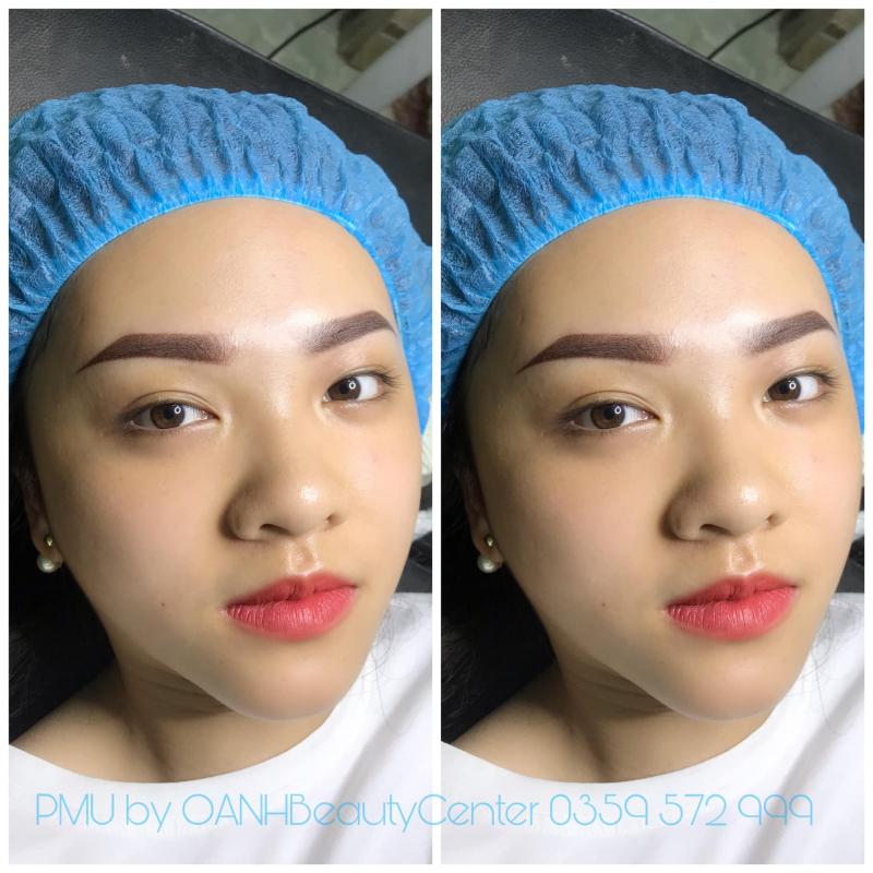 Thẩm mỹ Oanh Beauty Center