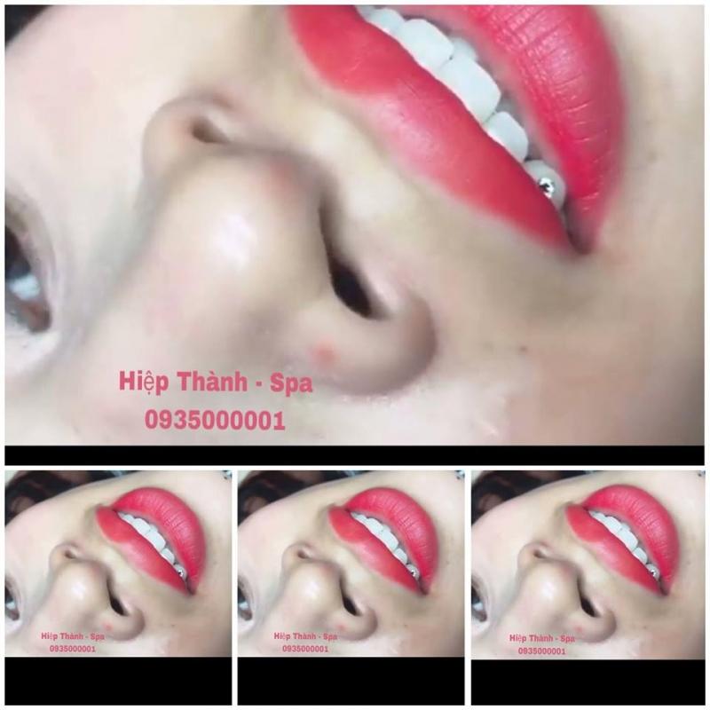 Thẩm Mỹ Công Nghệ Cao Hiệp Thành