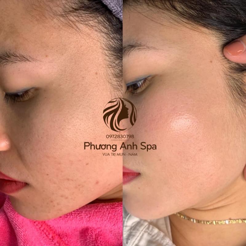 Phương Anh Spa