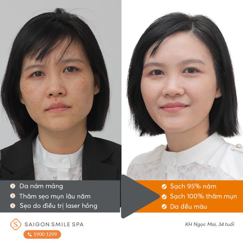 Saigon Smile Spa