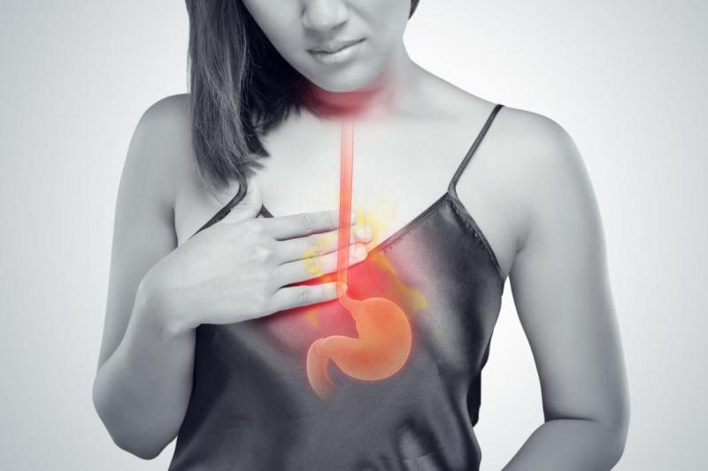Ợ nóng là một trong những tác dụng phụ của sản phẩm