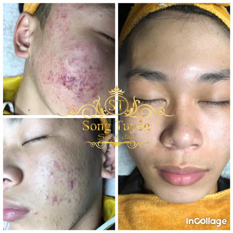 Song Tuyền Spa