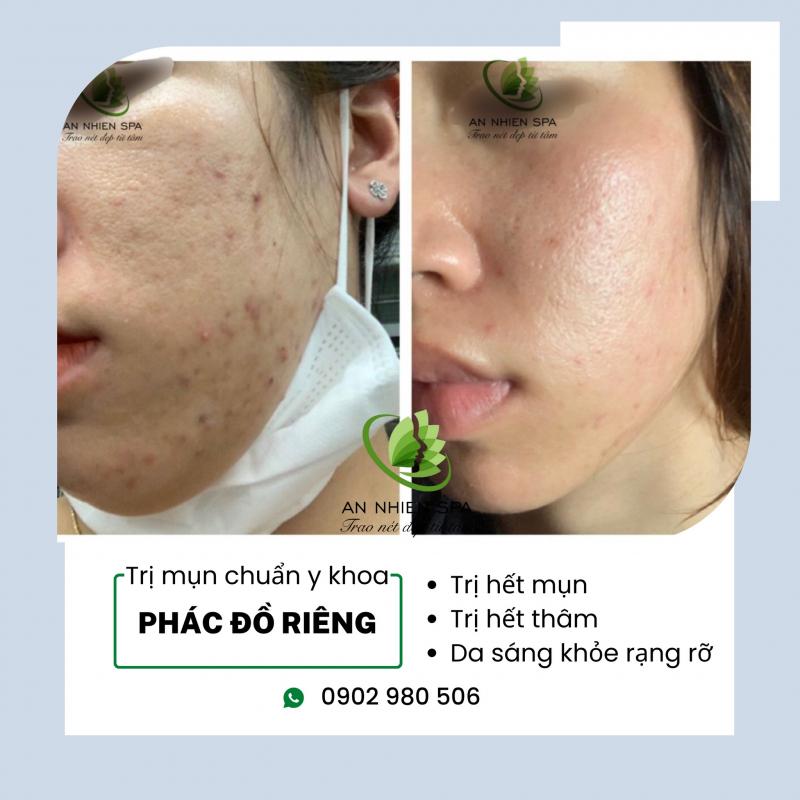 Spa An Nhiên-Bà Rịa