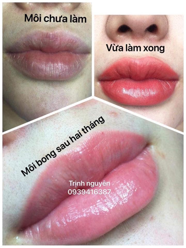 Spa Anna Sài Gòn