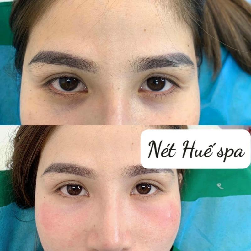 Spa Nét Huế