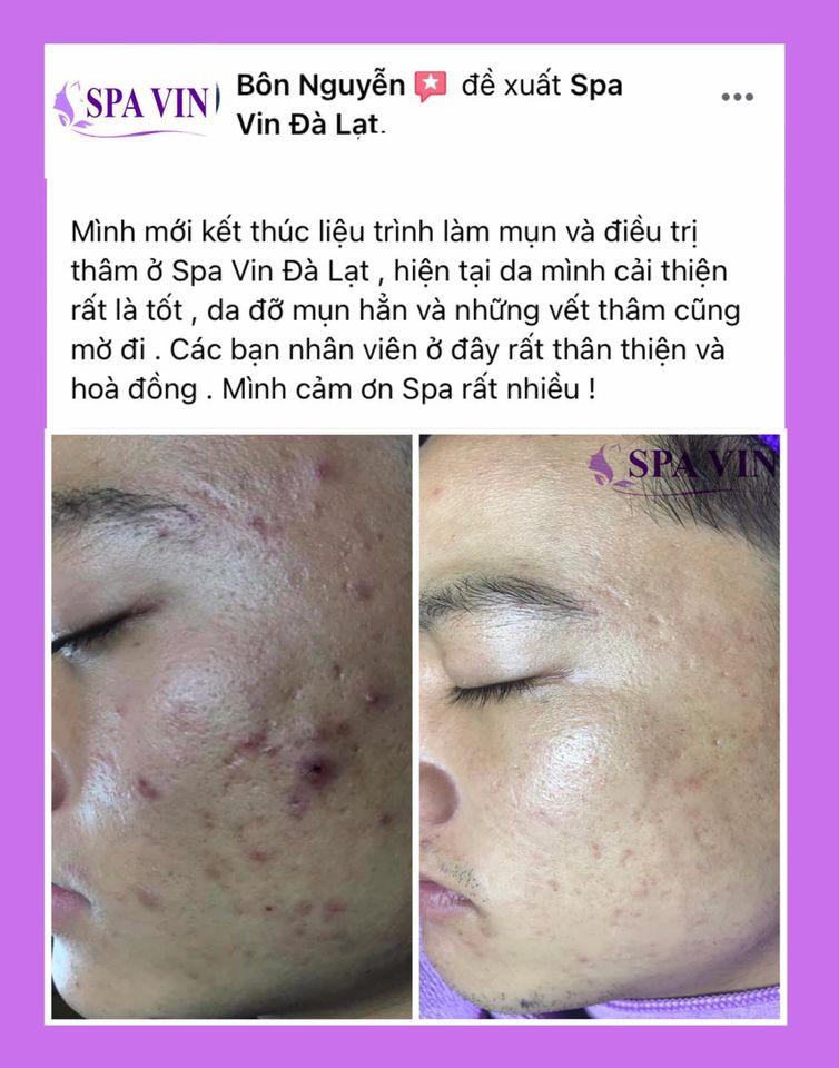 Spa Vin Đà Lạt
