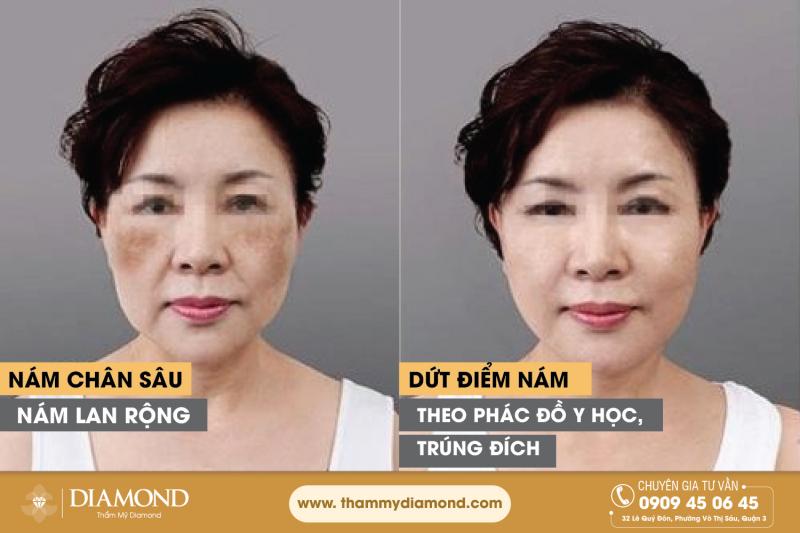 Thẩm Mỹ Diamond