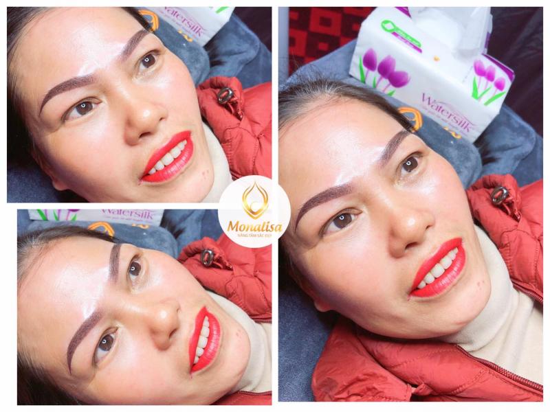 Thẩm mỹ Monalisa