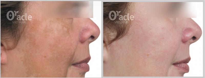 Thẩm Mỹ Oui International - Oracle Clinic