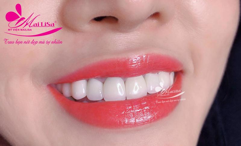 THẨM MỸ VIỆN MAILISA