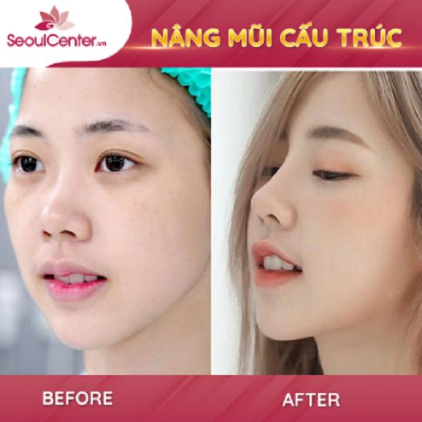 Thẩm Mỹ Viện SeoulSpa.Vn