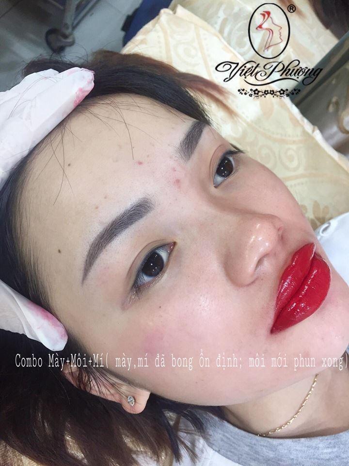 Thẩm mỹ Việt Phượng
