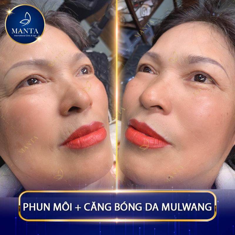 Viện thẩm mỹ Manta