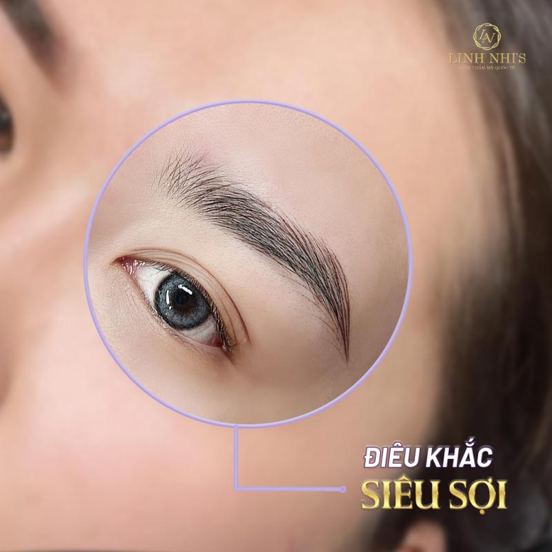 Viện Thẩm Mỹ Quốc Tế Linh Nhi'S