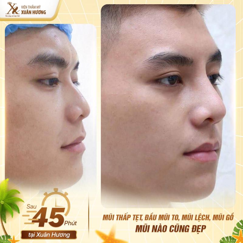 Viện thẩm mỹ Xuân Hương