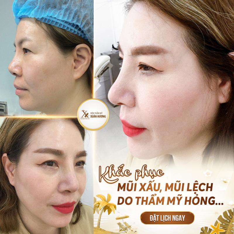 Viện thẩm mỹ Xuân Hương