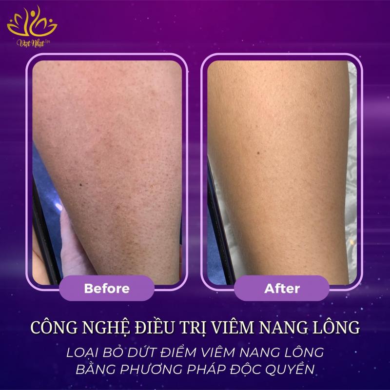 Việt Nhật Spa